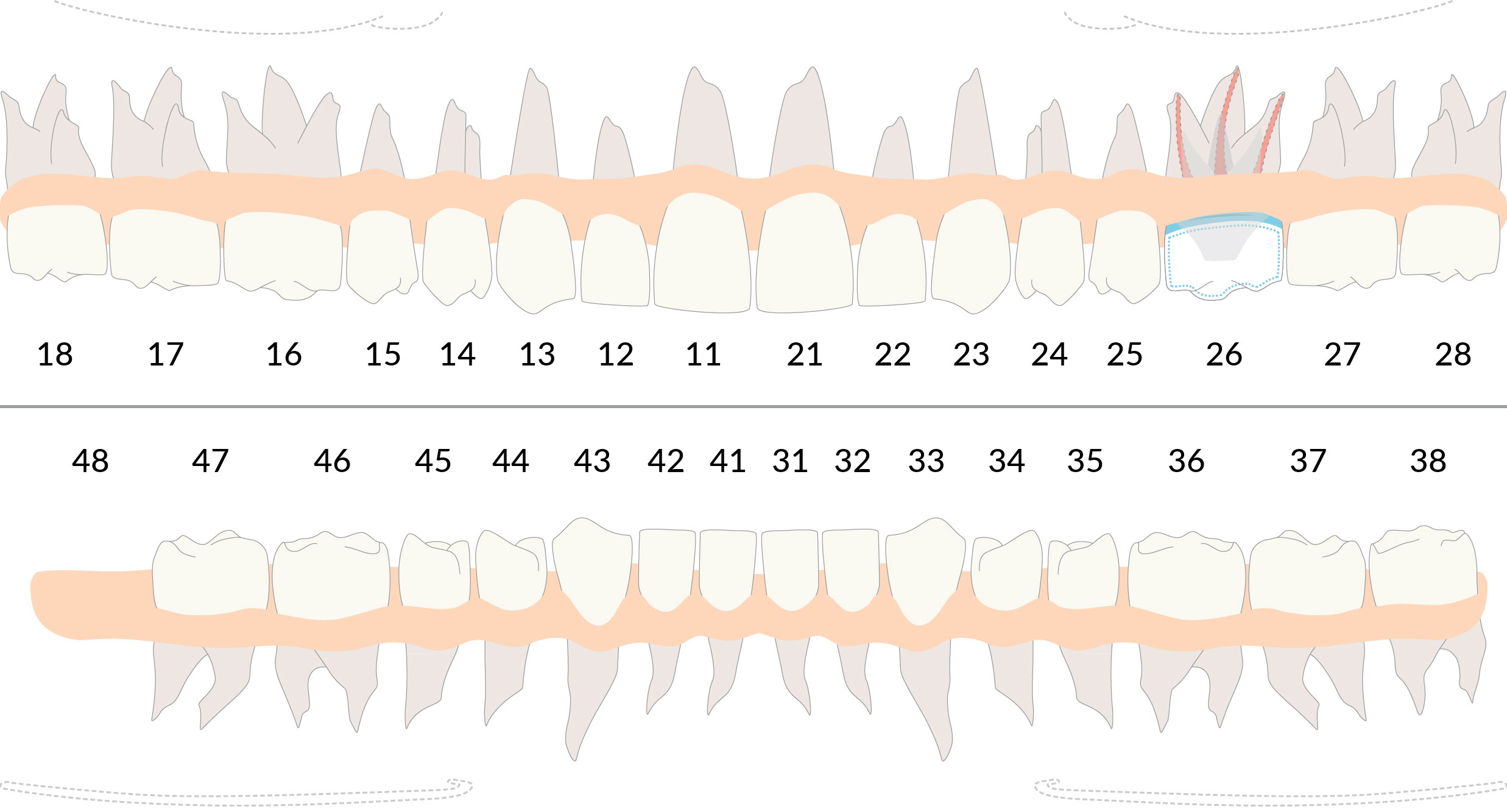 
Piani di trattamento di Endodonzia