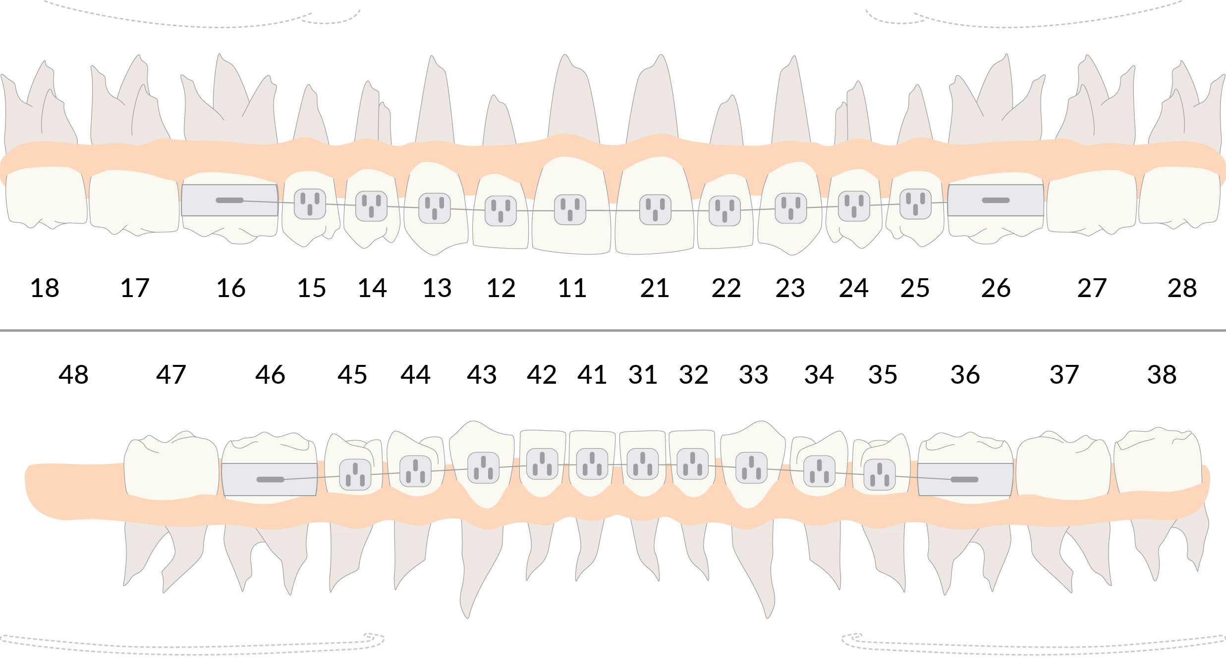 Piano di trattamento ortodonzia sul gestionale odontoiatrico DentalOpera