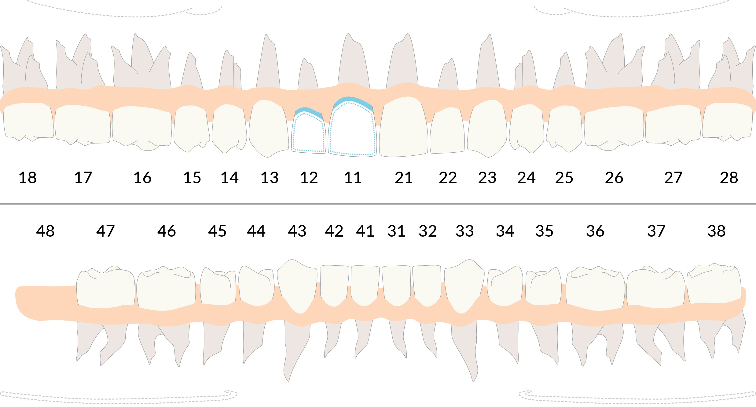 Inserire un piano di trattamento di protesi fissa sul gestionale odontoiatrico DentalOpera