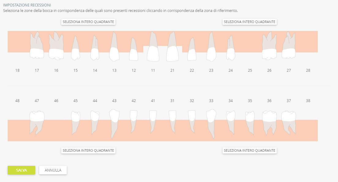 impostare le recessioni sul software per studi dentistici DentalOpera